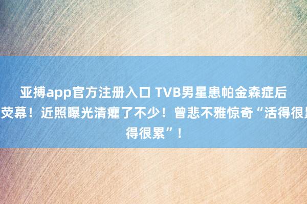 亚搏app官方注册入口 TVB男星患帕金森症后淡出荧幕！近照曝光清癯了不少！曾悲不雅惊奇“活得很累”！